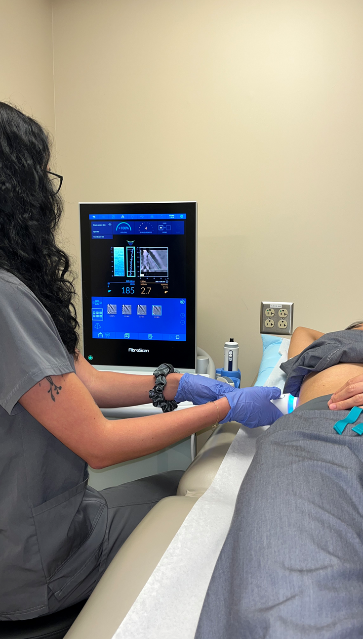 MASLD stage being determined with the use of a fibroscan